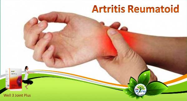 Mengenali Gejala Artritis Reumatoid