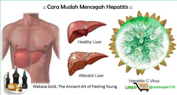 Cara Mudah Mencegah Hepatitis